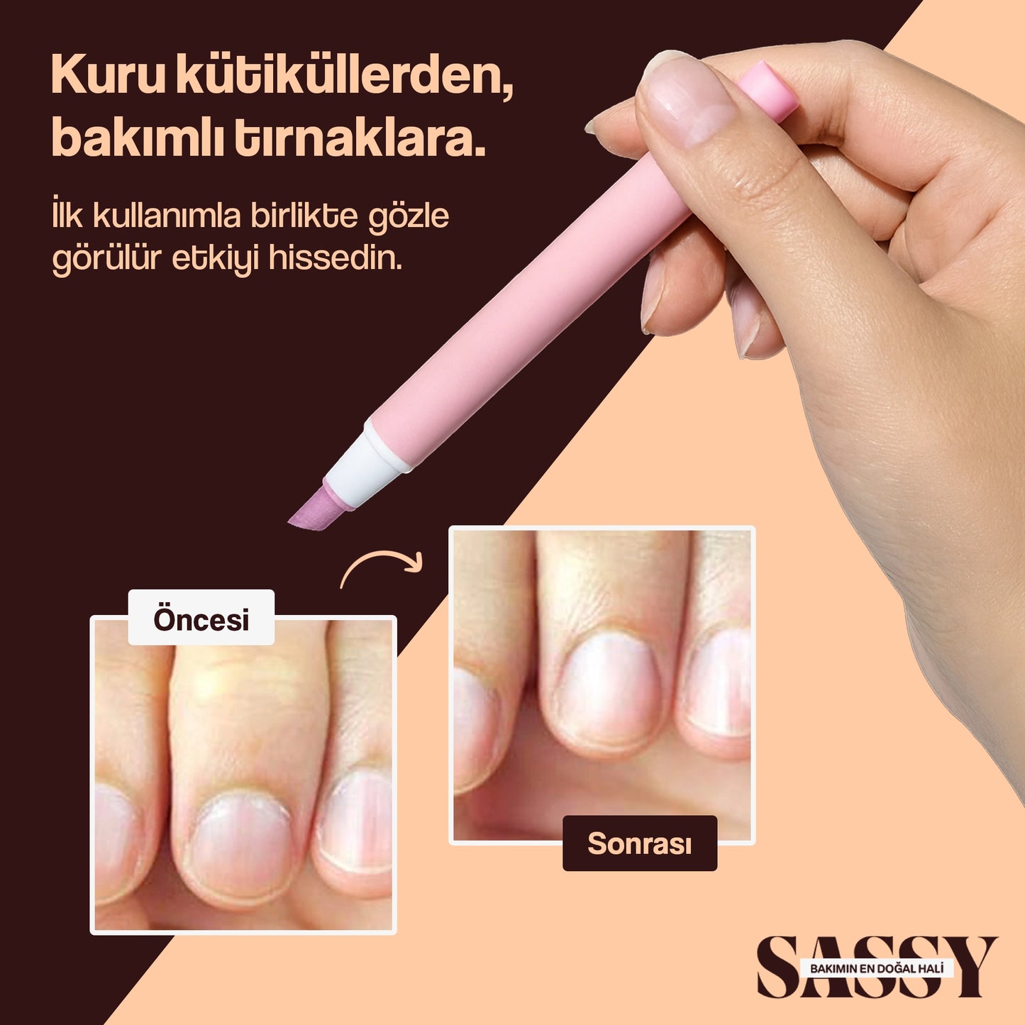 SassyTip 2’si 1 Arada Tırnak Bakım Kalemi